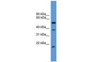 Image no. 1 for anti-serine Peptidase Inhibitor, Kunitz Type, 2 (SPINT2) (AA 91-140) antibody (ABIN6746573) (SPINT2 anticorps  (AA 91-140))