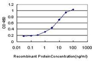 Detection limit for recombinant GST tagged PBX1 is approximately 0. (PBX1 anticorps  (AA 213-321))