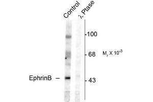 Image no. 1 for anti-Ephrin B1 (EFNB1) (pTyr331) antibody (ABIN372621) (Ephrin B1 anticorps  (pTyr331))