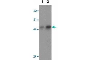 Western blot analysis of AP3M1 in human brain tissue lysate with AP3M1 polyclonal antibody  at (1) 1 and (2) 2 ug/mL. (AP3M1 anticorps  (C-Term))