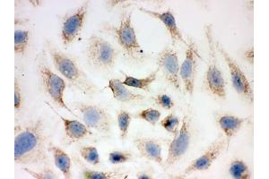 ICC testing of FFPE human HeLa cells with PRDX3 antibody. (Peroxiredoxin 3 anticorps  (AA 110-256))