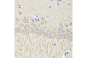 Immunohistochemistry of paraffin-embedded mouse brain using MAP1LC3B antibody. (LC3B anticorps)