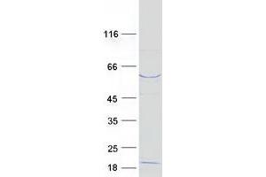 Validation with Western Blot