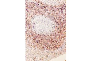 Anti-Diubiquitin antibody, IHC(P) IHC(P): Human Tonsil Tissue