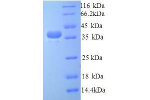 SDS-PAGE (SDS) image for Talin 1 (TLN1) (AA 92-399), (partial) protein (His tag) (ABIN5714532)