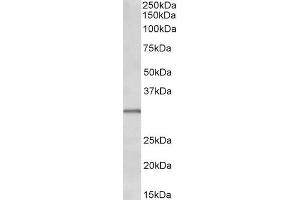 ABIN1590113 (0. (IGFBPI anticorps  (C-Term))