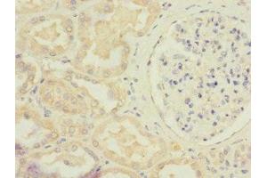 Immunohistochemistry of paraffin-embedded human kidney tissue using ABIN7170731 at dilution of 1:100 (STRADA anticorps  (AA 25-210))