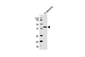 Western Blot at 1:1000 dilution + human placenta lysate Lysates/proteins at 20 ug per lane. (HSD3B1 anticorps  (N-Term))