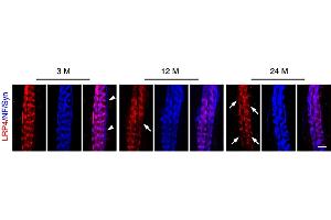 Representative images of EDL muscles of 3M, 12M, and 24 M-old mice, whole mount stained with 555-anti-LRP4 (Cat no (ABIN1304797), 1:200, red) and NF/Syn (blue).
