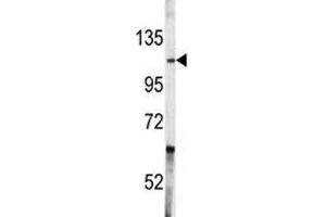 Western blot analysis of c-Abl antibody and A2058 lysate. (ABL1 anticorps  (AA 741-769))