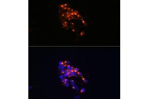 Immunofluorescence analysis of SH-SY5Y cells using Neurofilament M Rabbit mAb (ABIN7268864) at dilution of 1:100 (40x lens).