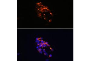 Immunofluorescence analysis of SH-SY5Y cells using Neurofilament M Rabbit mAb (ABIN7268864) at dilution of 1:100 (40x lens). (NEFM anticorps)