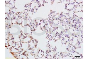 Formalin-fixed and paraffin embedded rat lung tissue labeled with Anti-PAX9 Polyclonal Antibody, Unconjugated (ABIN737691) at 1:200 followed by conjugation to the secondary antibody and DAB staining (PAX9 anticorps  (AA 271-341))