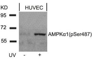 Western blot analysis of extracts from HUVEC cells untreated or treated with UV using AMPKa1(Phospho-Ser487)Antibody.