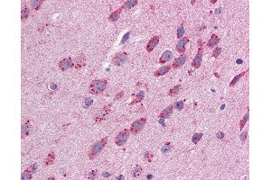 Anti-GJB3 antibody IHC of mouse brain.