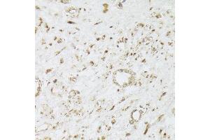 Immunohistochemistry of paraffin-embedded human leiomyoma of uterus using CIAPIN1 Antibody. (CIAPIN1 anticorps  (AA 1-312))