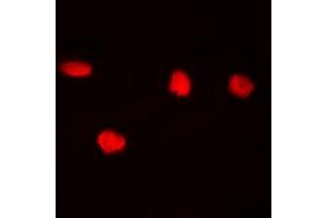 Immunofluorescent analysis of CDC25C (pS216) staining in Hela cells. (CDC25C anticorps  (pSer216))