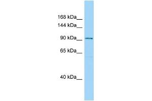 WB Suggested Anti-SPAG1 Antibody Titration: 1. (SPAG1 anticorps  (C-Term))