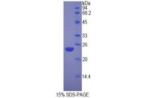 SDS-PAGE (SDS) image for Nucleolin (NCL) (AA 388-569) protein (His tag) (ABIN1877991)