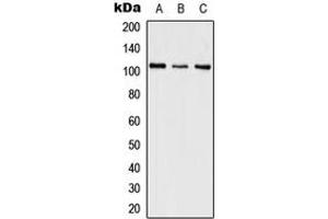 Western blot analysis of SWAP expression in HeLa (A), SP2/0 (B), PC12 (C) whole cell lysates. (SFRS8 anticorps  (Center))