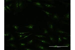 Immunofluorescence of monoclonal antibody to KDM6A on HeLa cell. (KDM6A anticorps  (AA 641-740))