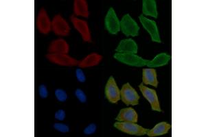 ABIN6260383 and ABIN6279247 staining Hela cells(30 min of UV treatment) by IF/ICC.