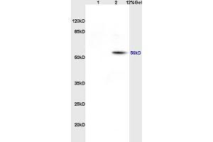 Lane 1: rat heart lysates Lane 2: rat brain lysates probed with Anti EAAT1/Glast Polyclonal Antibody, Unconjugated (ABIN730783) at 1:200 in 4 °C.