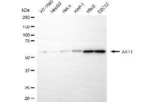 Western blotting analysis using AKT1 antibody (ABIN7800780).