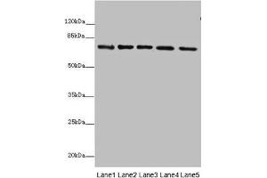 Western blot All lanes: SDHA antibody at 10 μg/mL Lane 1: Rat heart tissue Lane 2: Mouse spleen tissue Lane 3: Mouse liver tissue Lane 4: Hela whole cell lysate Lane 5: Zebrafish lysate Secondary Goat polyclonal to rabbit IgG at 1/10000 dilution Predicted band size: 73, 68, 57 kDa Observed band size: 73 kDa (SDHA anticorps  (AA 44-664))
