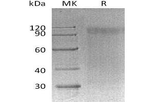 Western Blotting (WB) image for Signal-Regulatory Protein alpha (SIRPA) protein (ABIN7320648) (SIRPA Protéine)