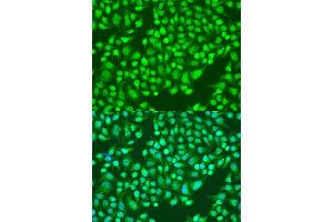 Immunofluorescence analysis of U2OS cells using ITGA2 antibody. (ITGA2 anticorps)