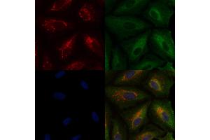 ABIN6259707 and ABIN6276744 staining  cells by IF/ICC. (ABO anticorps  (N-Term))