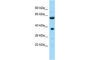 Host: Rabbit Target Name: Ndufa10l1 Sample Type: Rat Pancreas lysates Antibody Dilution: 1. (NDUFA10L1 anticorps  (C-Term))