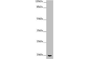 Western blot All lanes: CETN1 antibody at 2. (Centrin 1 anticorps  (AA 1-172))