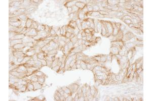 Immunohistochemistry (IHC) image for anti-Adducin 1 (Alpha) (ADD1) (AA 632-682) antibody (ABIN7454952) (alpha Adducin anticorps  (AA 632-682))