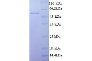 V-Set Domain Containing T Cell Activation Inhibitor 1 (VTCN1) (AA 26-258), (partial) protein (GST tag)