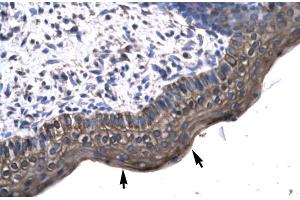 Human Spermatophore (KIN anticorps  (Middle Region))