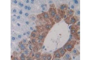Used in DAB staining on fromalin fixed paraffin- embedded Kidney tissue