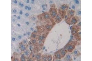 Used in DAB staining on fromalin fixed paraffin- embedded Kidney tissue (CRYBA1 anticorps  (AA 1-215))