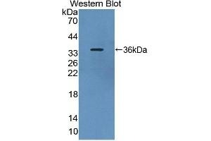 Detection of Recombinant PDE4B, Rat using Polyclonal Antibody to Phosphodiesterase 4B, cAMP Specific (PDE4B) (PDE4B anticorps  (AA 500-736))