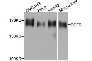 Western blot analysis of extracts of various cell lines, using EGFR antibody. (EGFR anticorps  (AA 1021-1210))
