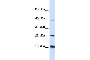 WB Suggested Anti-UBE2D2 Antibody Titration:  0. (UBE2D2 anticorps  (N-Term))