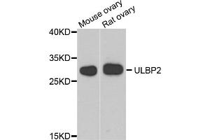 Western blot analysis of extracts of various cell lines, using ULBP2 antibody (ABIN5974540) at 1/1000 dilution. (ULBP2 anticorps)