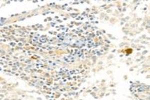 Immunohistochemistry analysis of paraffin-embedded human lymph node using PARP1 (ABIN7075114) at dilution of 1: 750 (PARP1 anticorps  (cleaved))
