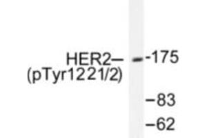 Image no. 1 for anti-Receptor tyrosine-protein kinase erbB-2 (ErbB2/Her2) (pTyr1221), (pTyr1222) antibody (ABIN318035) (ErbB2/Her2 anticorps  (pTyr1221, pTyr1222))