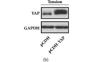 Forced overexpression of YAP promotes the osteogenic differentiation of HPDLCs. (YAP1 anticorps)