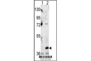 Western blot analysis of P38 using P38 Antibody using 293 cell lysates (2 ug/lane) either nontransfected (Lane 1) or transiently transfected with the MAPK14 gene (Lane 2). (MAPK14 anticorps  (C-Term))