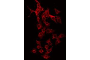 ABIN6267015 staining HeLa by IF/ICC.