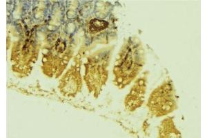 ABIN6279064 at 1/100 staining Mouse colon tissue by IHC-P.