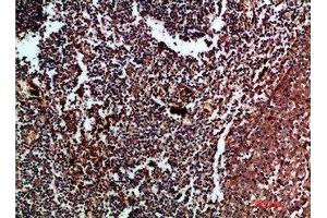 Immunohistochemical analysis of paraffin-embedded human-tonsil, antibody was diluted at 1:200